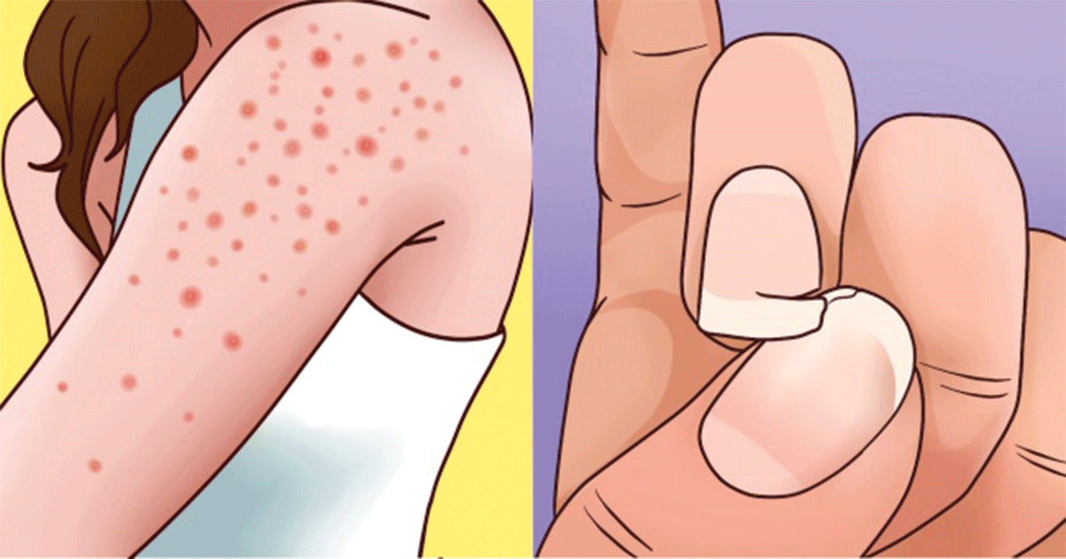 9 Signs You’re Gluten Sensitive, and This Is Important to Know