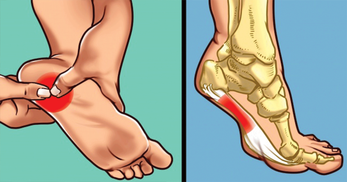 What to Do If Your Heel Hurts in the Morning or Every Time You Stand Up