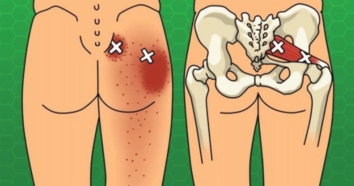 Keep Your Sciatic Back And Hip Pain Under Control With 6 Stretches