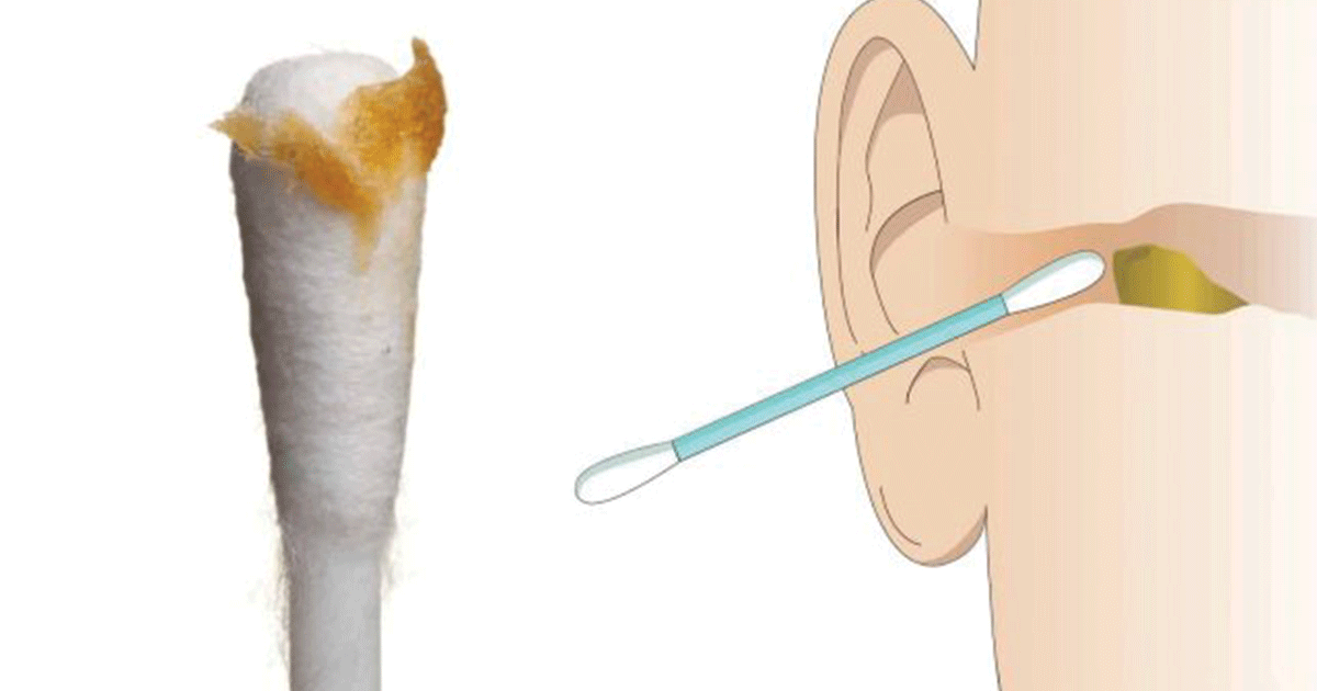 Ear Specialists Explain 6 Reasons To Stop Cleaning Ears With Cotton Buds