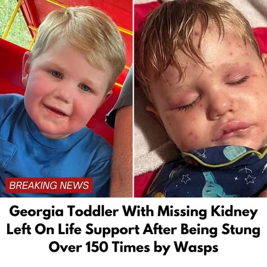 Georgia Toddler Stung Over 150 Times by Yellow Jackets, Fighting for Life