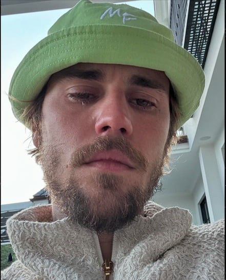 Justin Bieber’s Health Sparks Concern — Fans Notice Alarming Changes