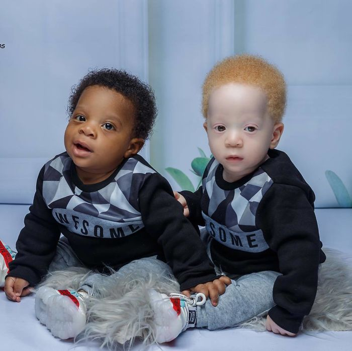 Mom of “Black and White” Twins Shares Their Inspiring Story — And Why Strangers Always Ask the Same Question