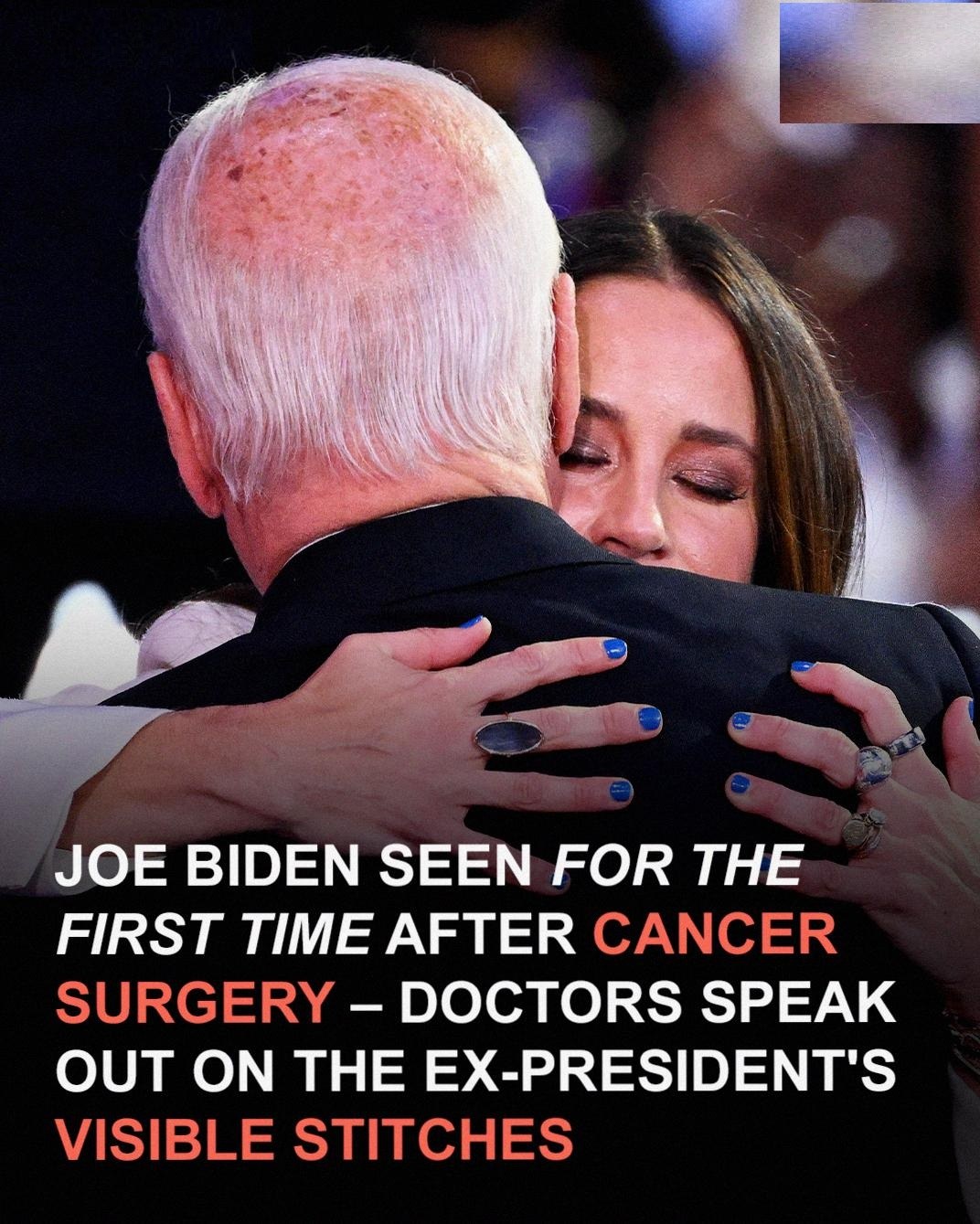 Former President Joe Biden, 82, Undergoes Surgery Amid Ongoing Health Battle