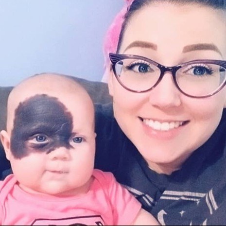 Natalie Jackson’s Story: Brave Little Girl With CMN Inspires the World