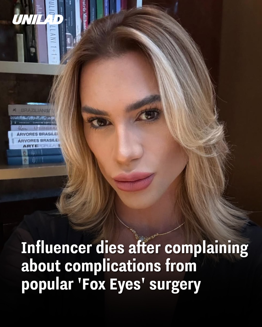 💔 Influencer Dies After Complaining About Complications from Popular ‘Fox Eyes’ Surgery