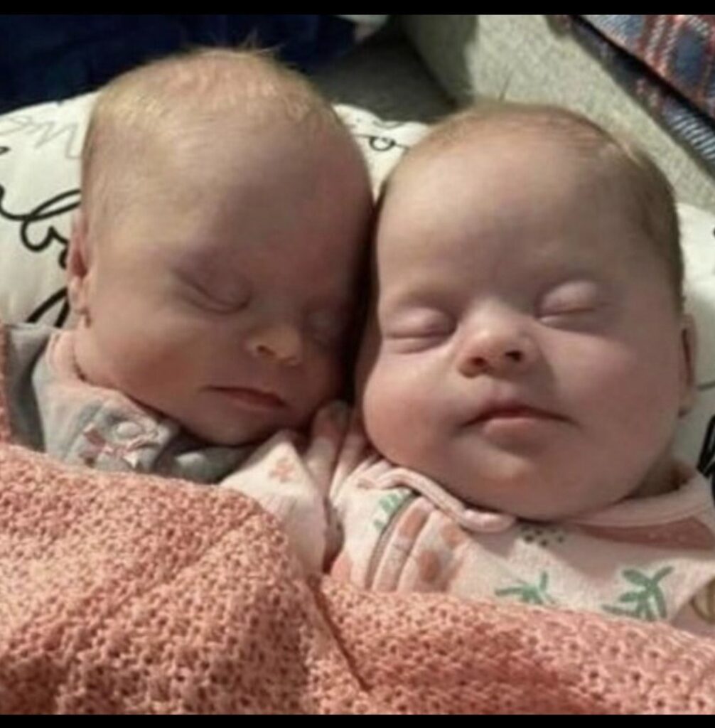 Mom of Identical Twins with Down Syndrome Silences Haters with Powerful Message of Love Mom of Identical Twins with Down Syndrome Silences Haters with Powerful Message of Love