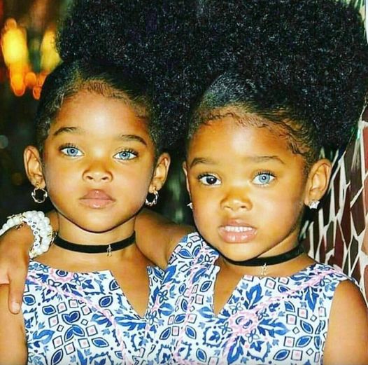 The “Trueblue Twins”: How Megan and Morgan Boyd Captivated the World with Their Stunning Blue Eyes