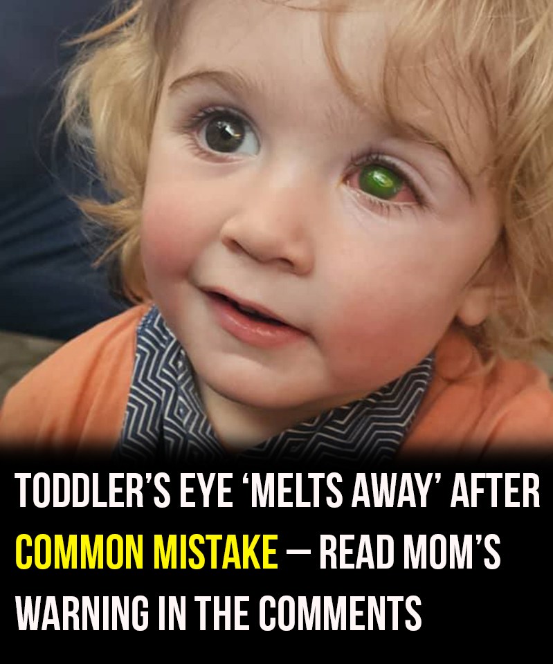 Toddler Loses Sight After “Innocent” Kiss Turns Into a Nightmare